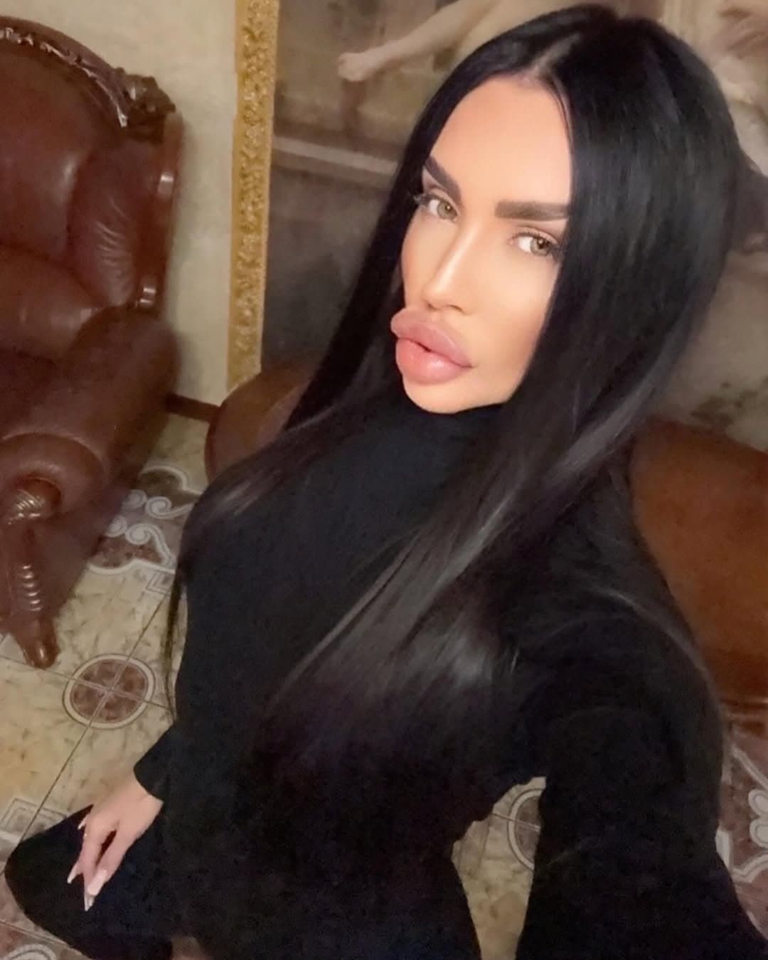 Huge Bimbo Duck Lips