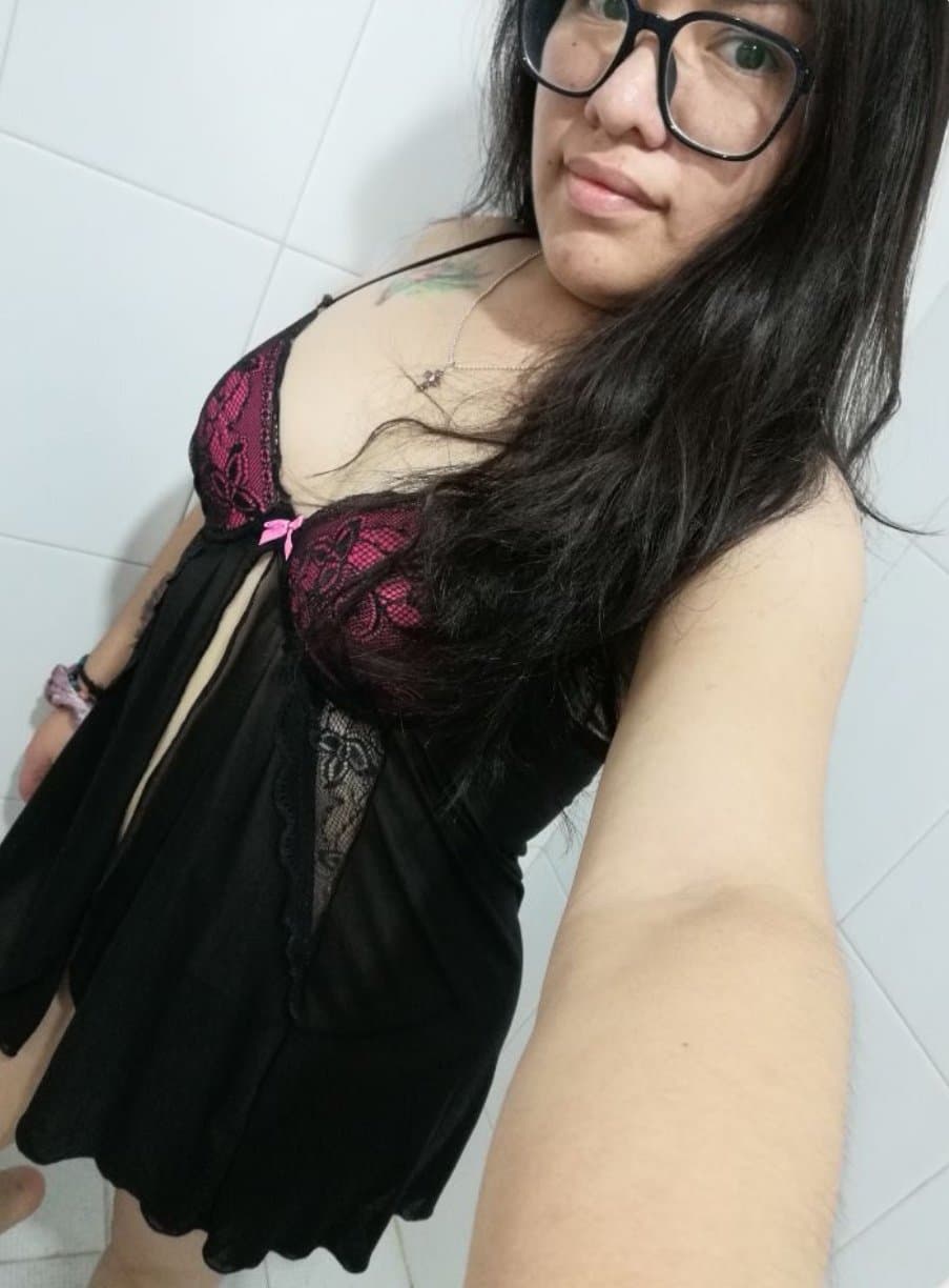 Ana ex alumna de la Unitec Campus Sur quemada por su esposo