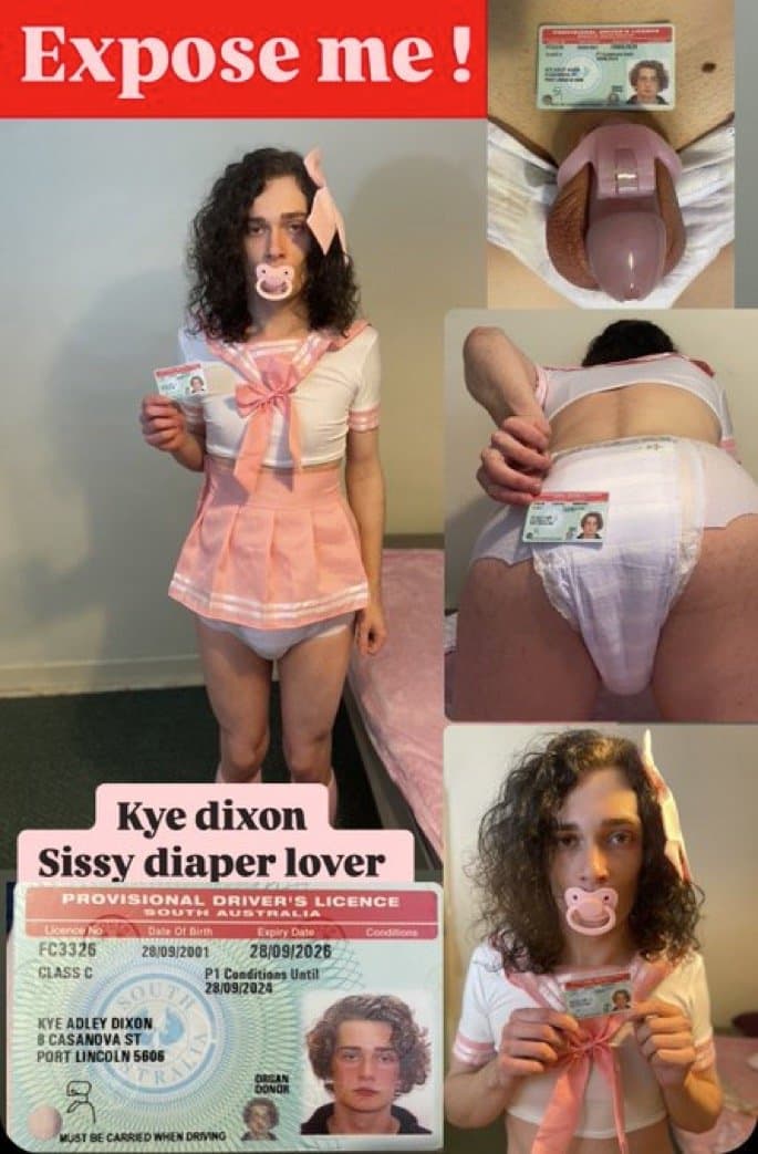 Kye Dixon Diaper Sissy Faggot