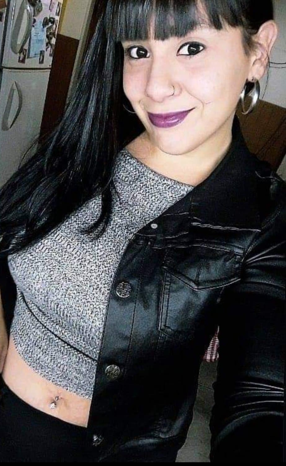 Sandra, 10 mins before removing