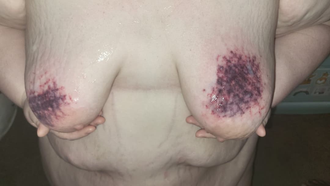 Heavy BDSM Brusing Over A Week