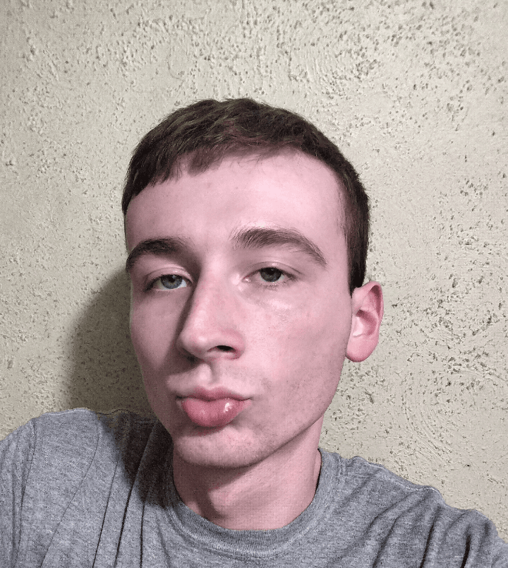 Beautiful 20 year old face leak