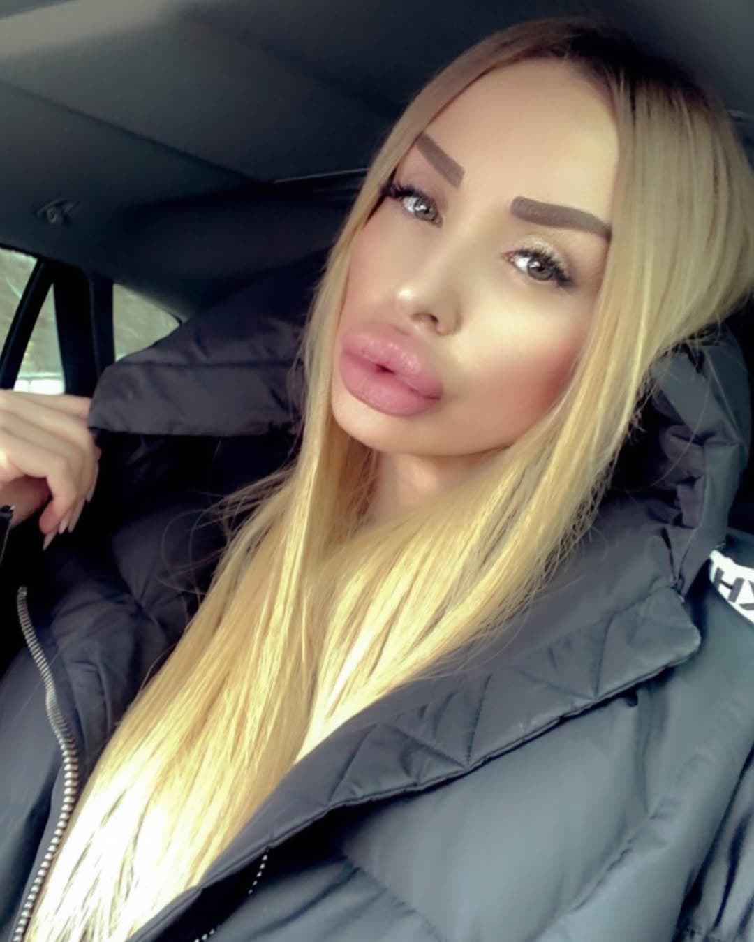 Huge Bimbo Duck Lips