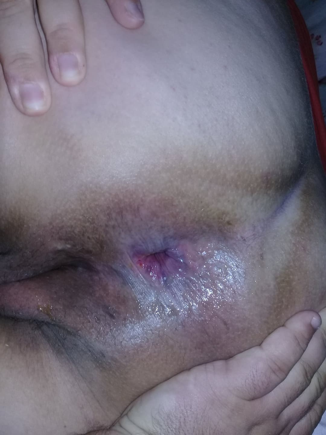 Esposa gorda arrombada oque vcs fariam? Oque vcs acham ?