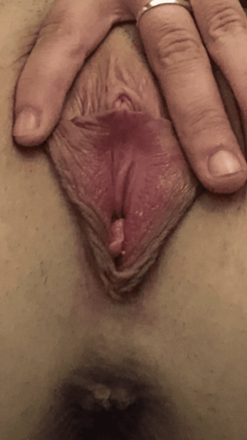 Deep dimples as well as a deep cunt on this young gorgeous whore??