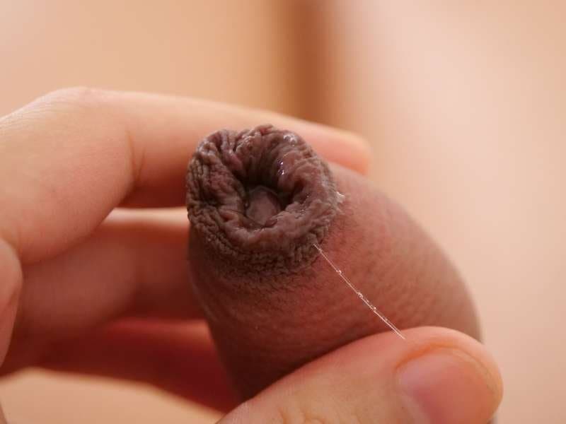 Click to view full size Cute Femboy girl foreskin close up