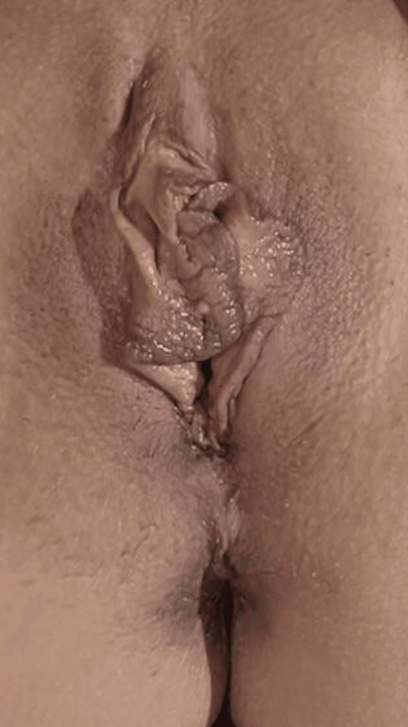 Nicely aged Whore with rebuilt tits and a fluffy cunt