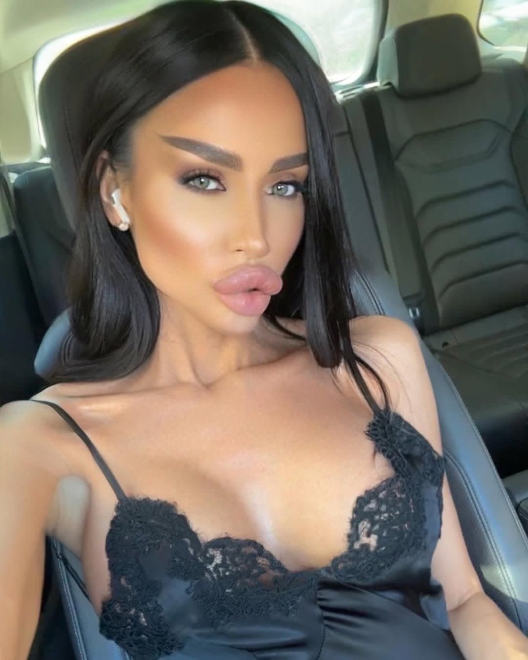 Huge Bimbo Duck Lips