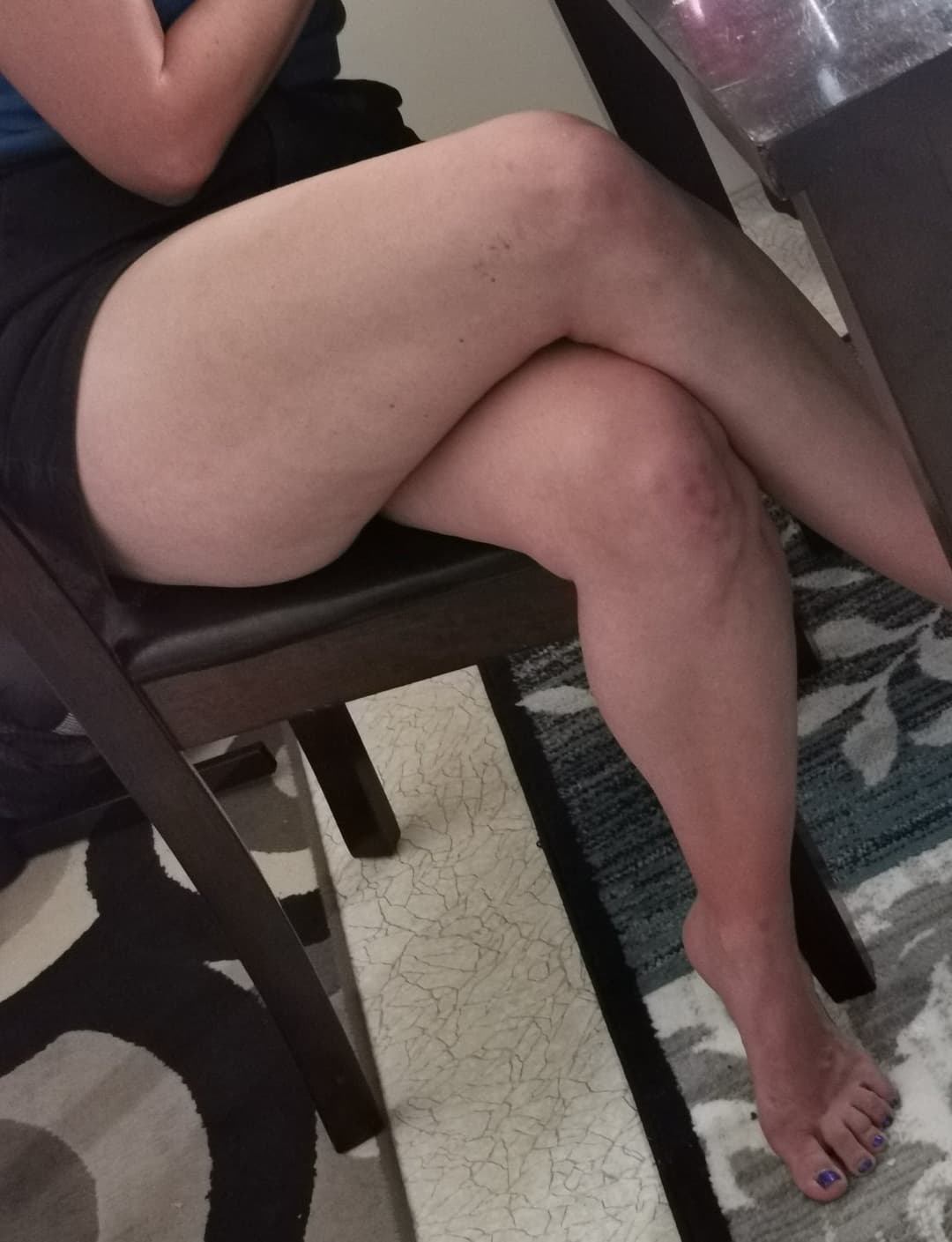SIL was teasing me with her feet and thighs. Love her tanlines and long toes