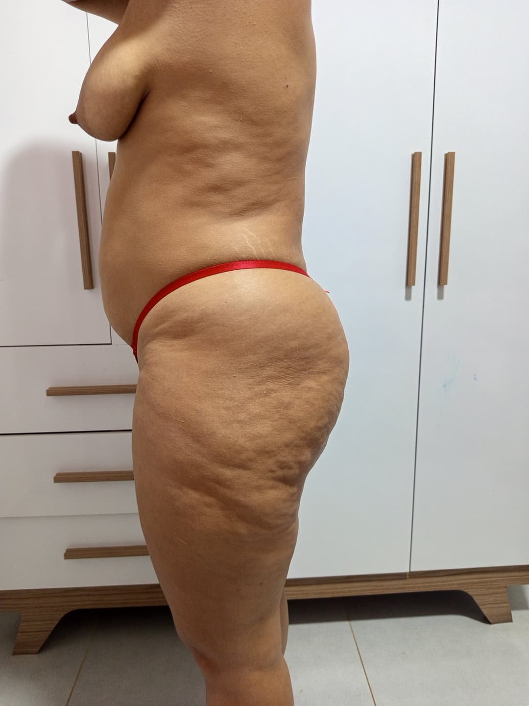 Bundona da esposa com celulite