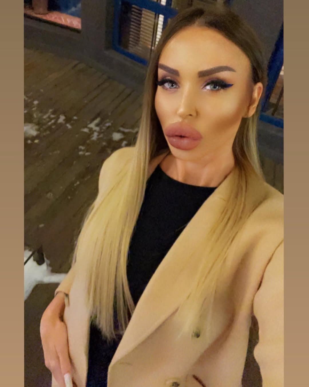 Huge Bimbo Duck Lips