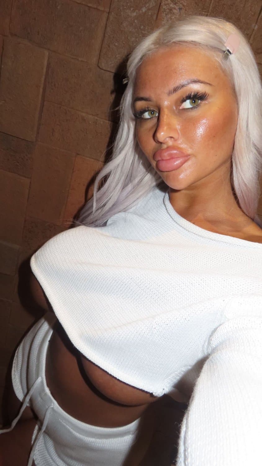 Beautiful big fake lips big fake tits botox silicone bimbo