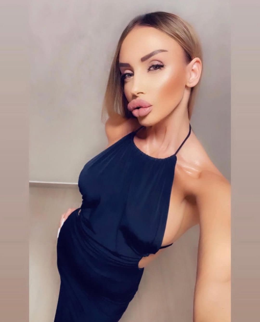 Huge Bimbo Duck Lips