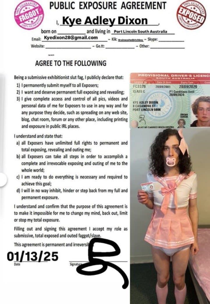 Kye Dixon Diaper Sissy Faggot