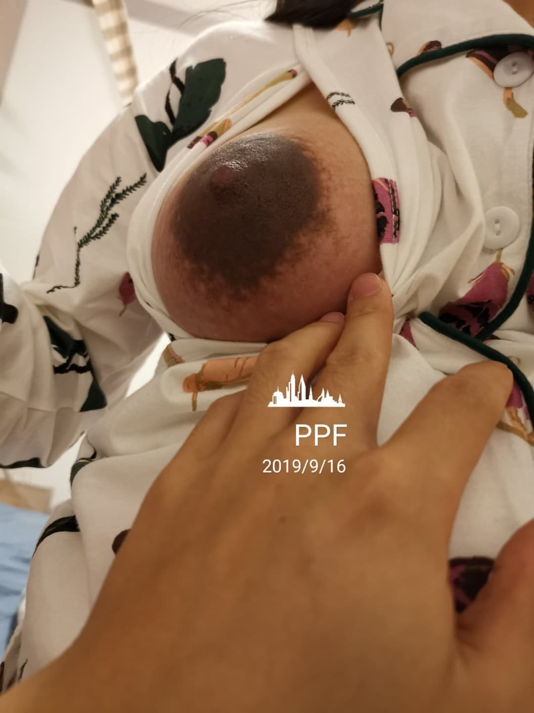 Huge areolas on huge preggo tits - ddɟƖϛㄥƖϛㄥ