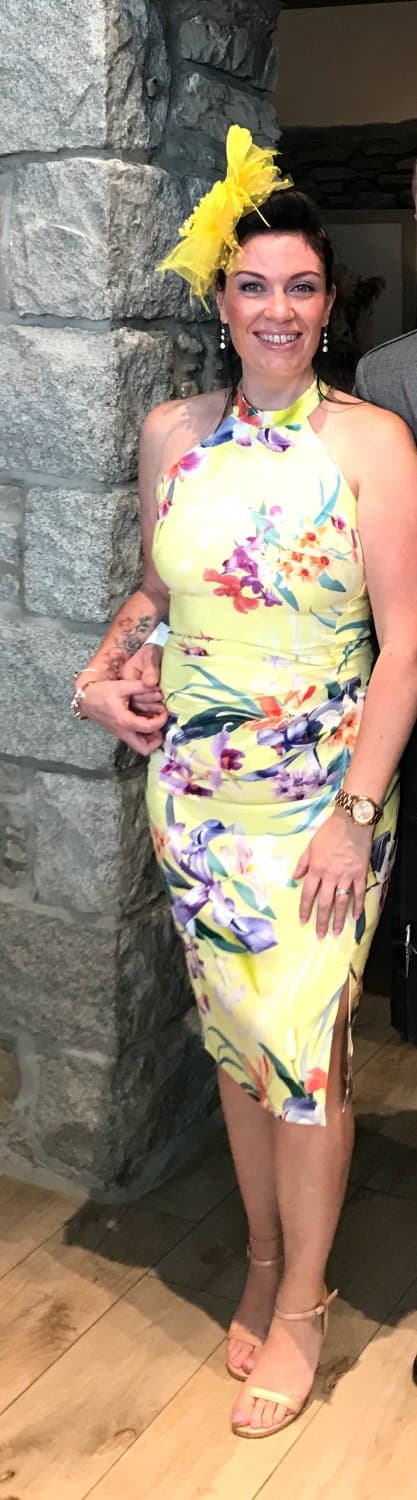 Fiona Thomas East Kilbride Glasgow Lanarkshire Glasgow freckles prove