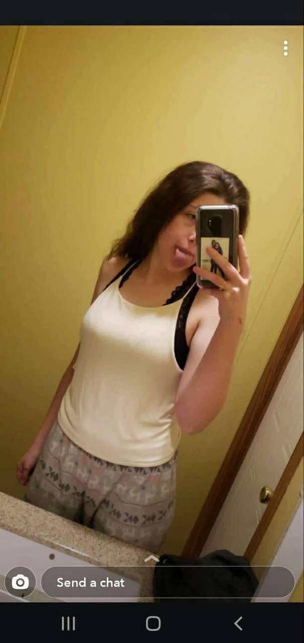 Brace face and her fart dispenser she loves to fart out of