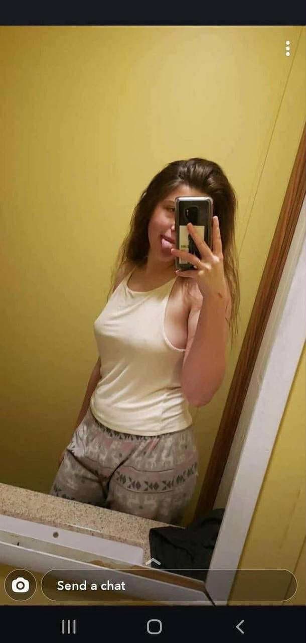 Brace face and her fart dispenser she loves to fart out of