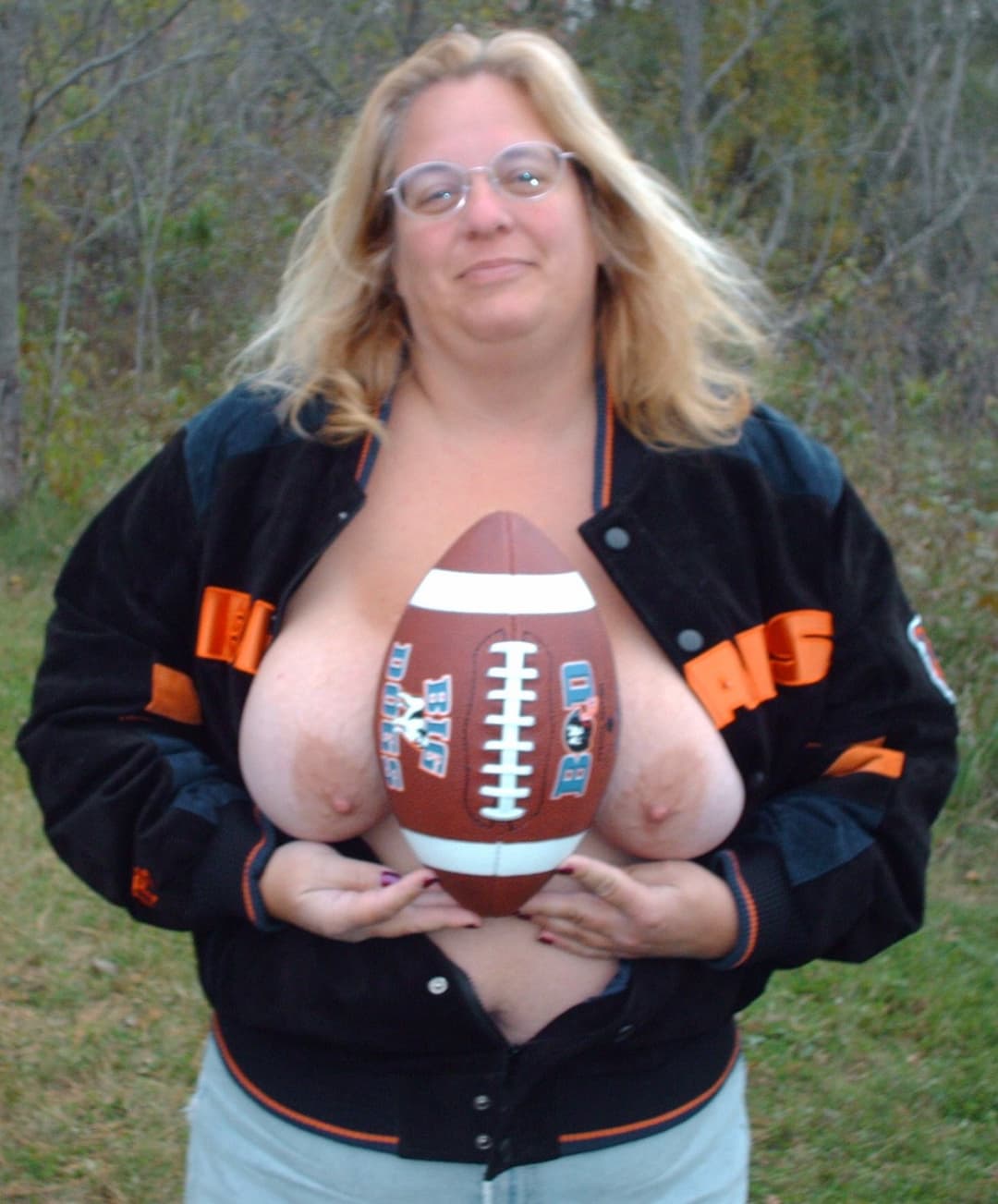 Breast reduction 38DDDs to 38Cs