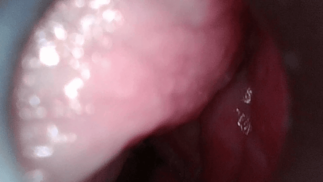 With the endoscope in her vagina, fingered her, licked her, and then insert my penis and cum inside.