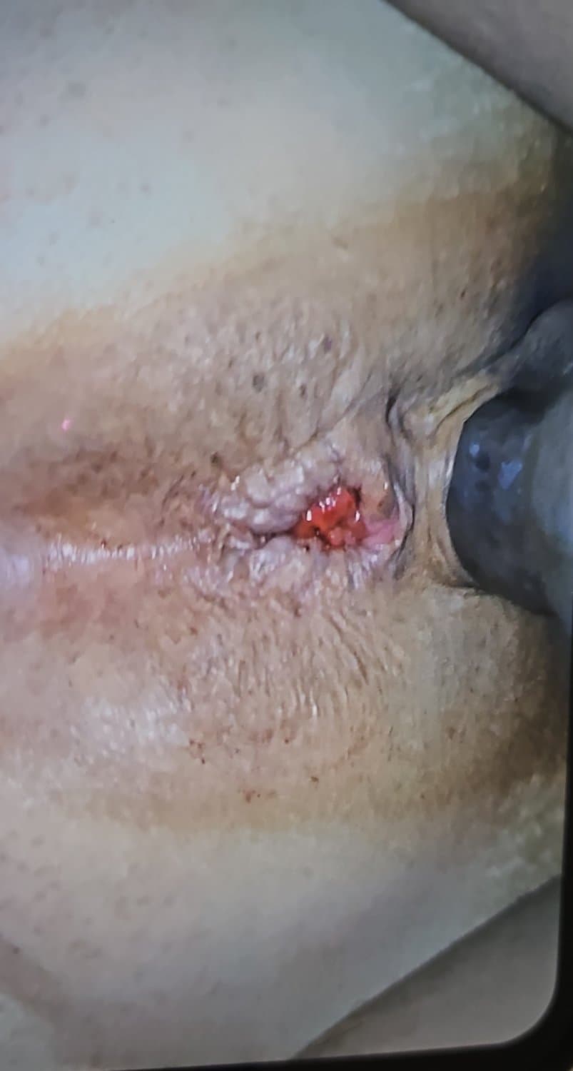 Cornudo Le Cumple Fantasía A Doña ...