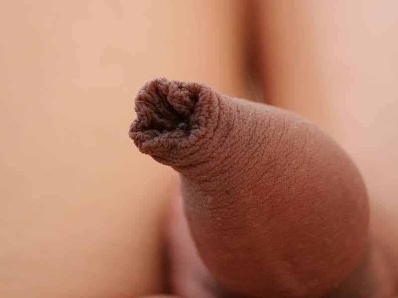 Click to view full size Cute Femboy girl foreskin close up