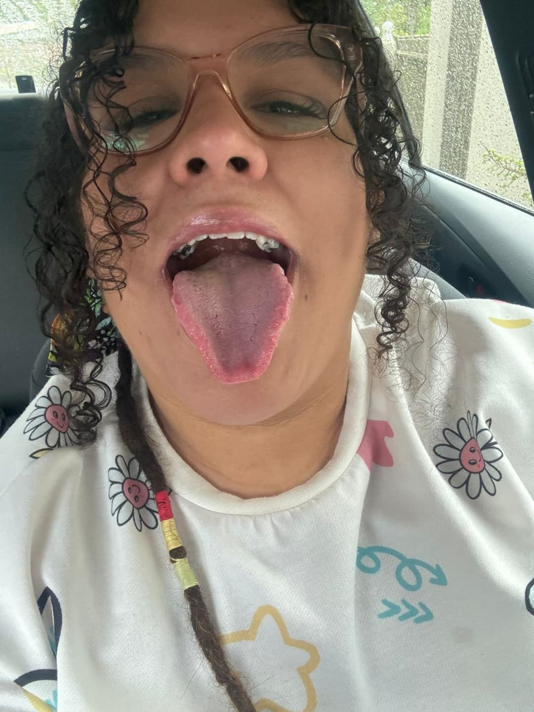 Click to view full size Whore-wife Face fetish (nose, forehead, tongue, teeth, mouth, ears, throat) Gaped, used hole