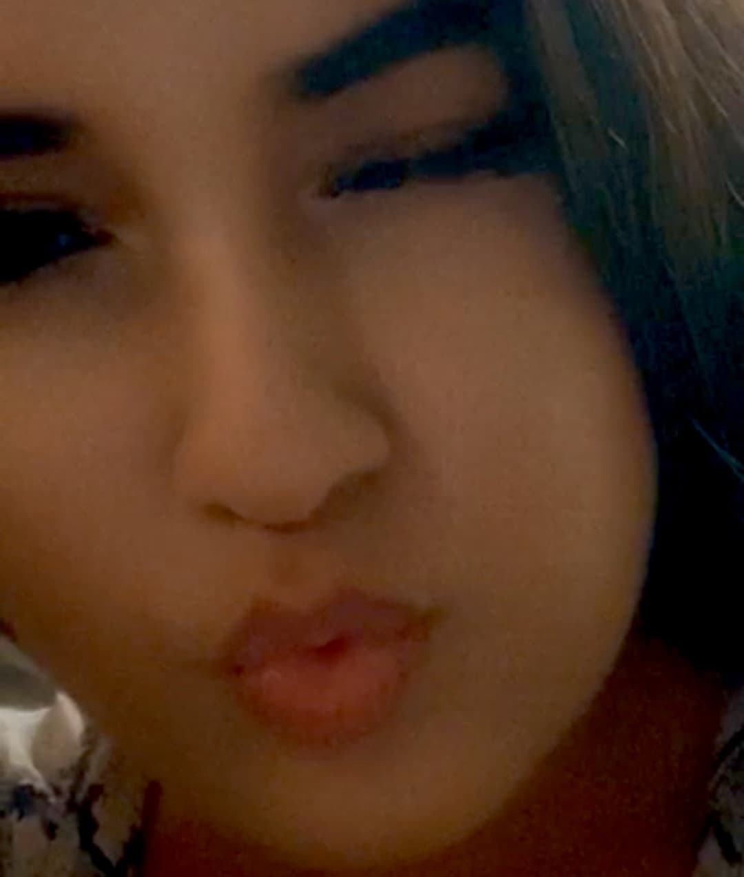 AFGHANI STREET DOG ZUHAL WITH STINKY ASS