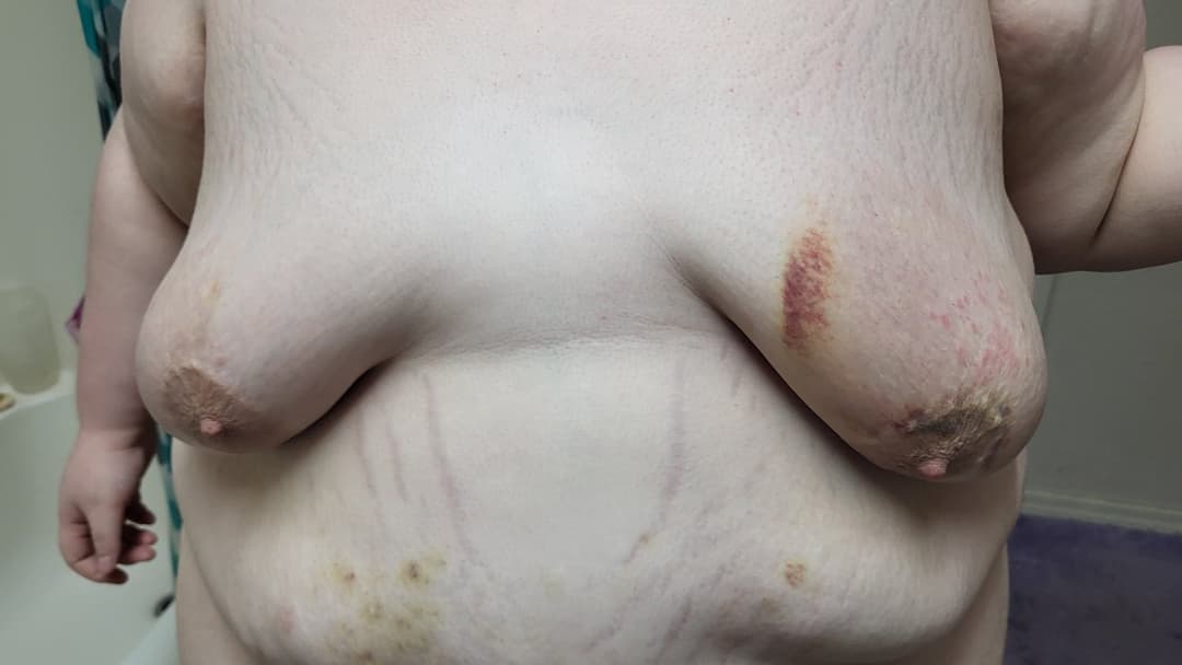 Heavy BDSM Brusing Over A Week