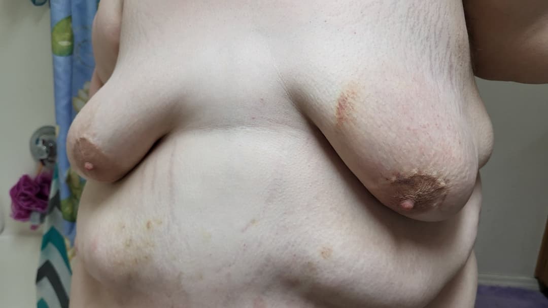 Heavy BDSM Brusing Over A Week