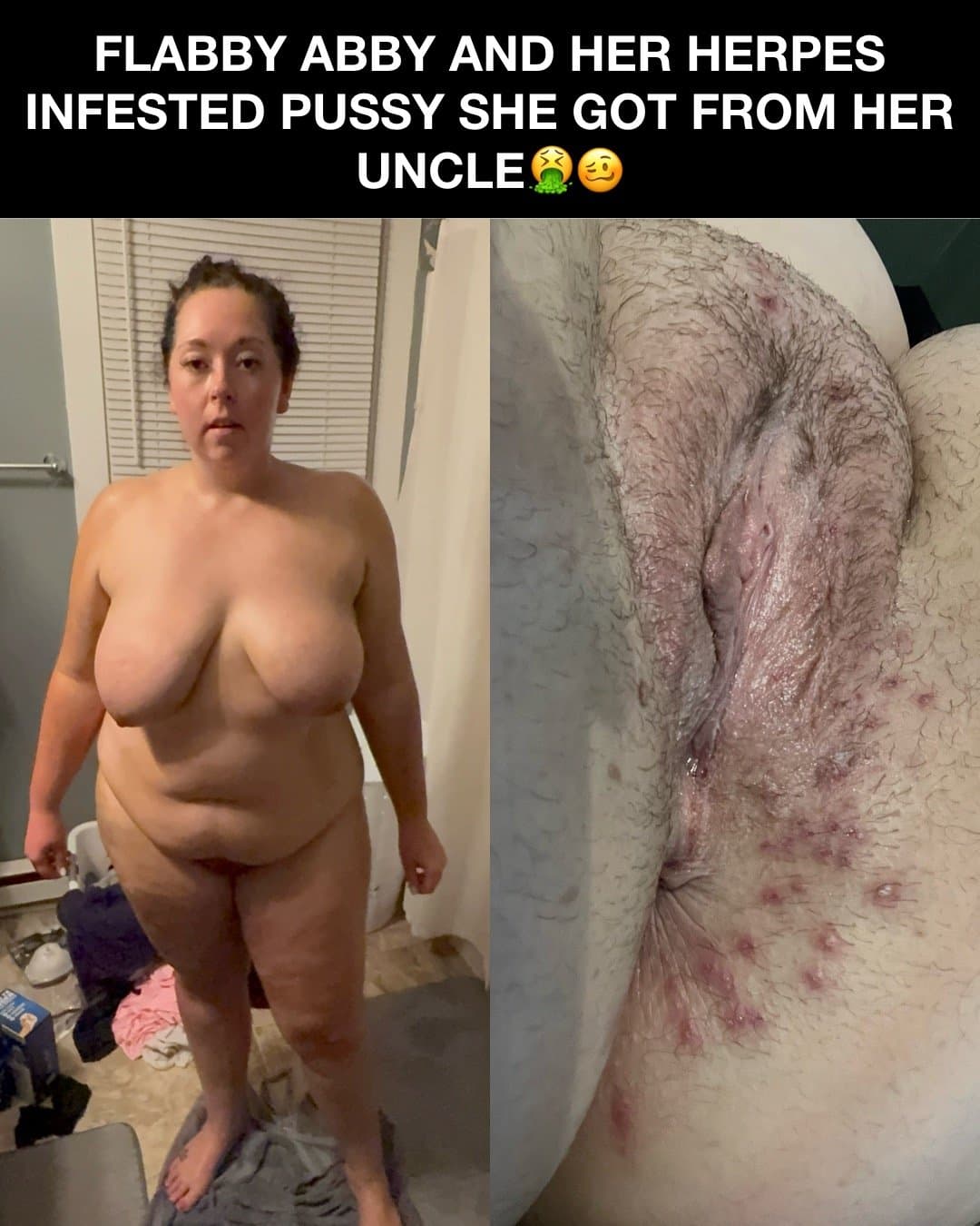 Click to view full size Flabby Abby bred by her Uncle!! Kik: mygirl4usecny