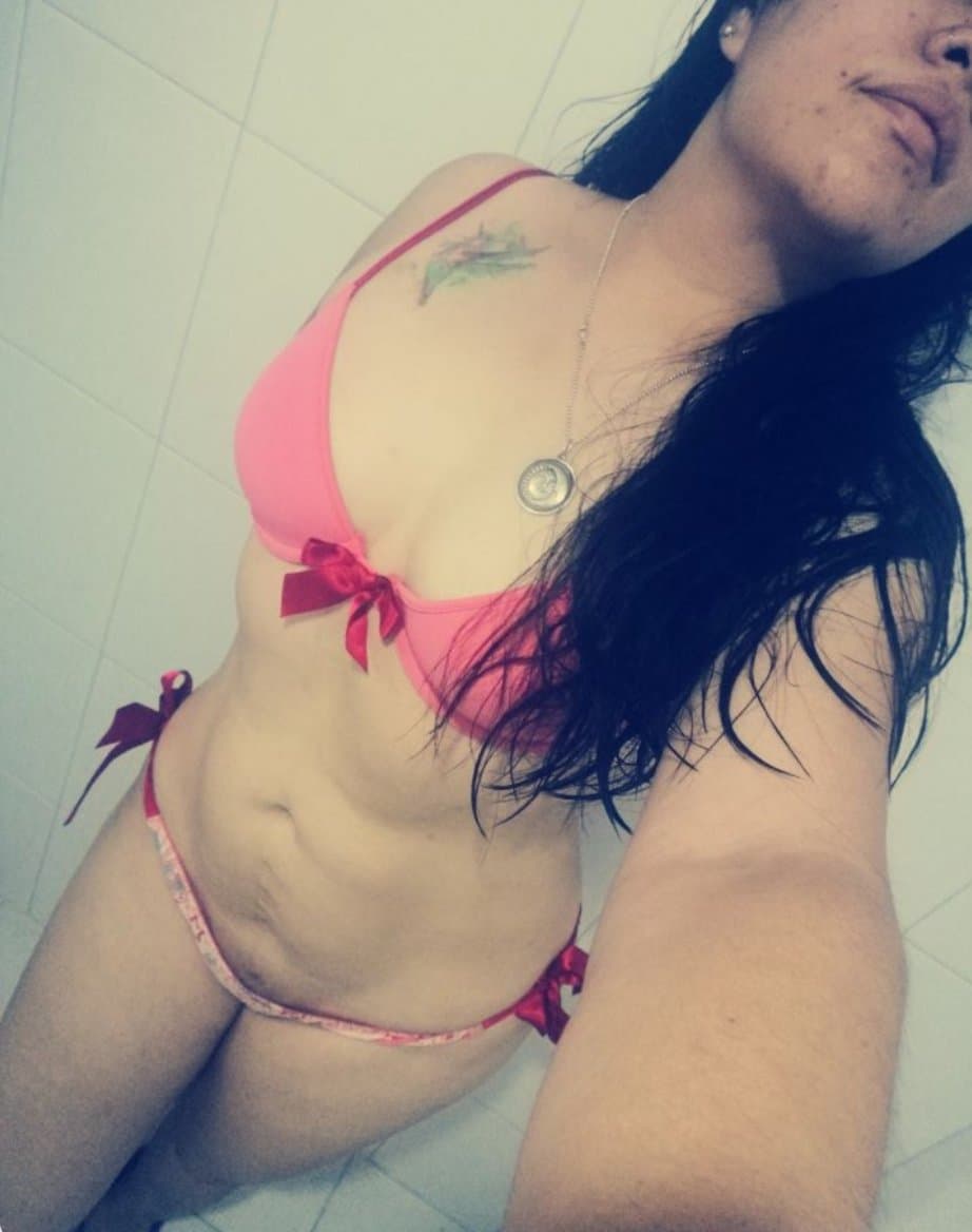 Ana ex alumna de la Unitec Campus Sur quemada por su esposo