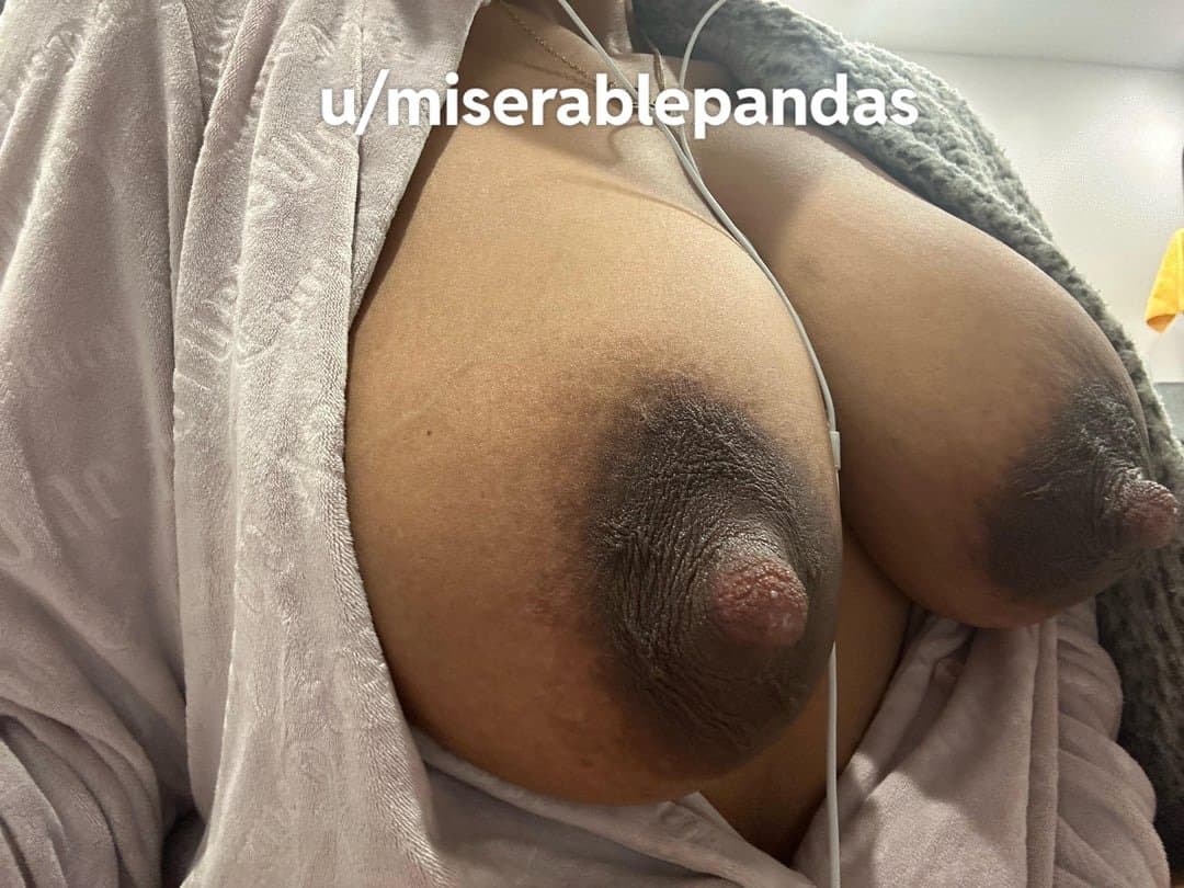 Brown areolas
