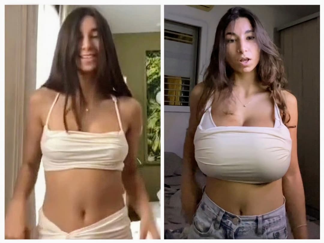 Incredible natural breast growth over the past six months