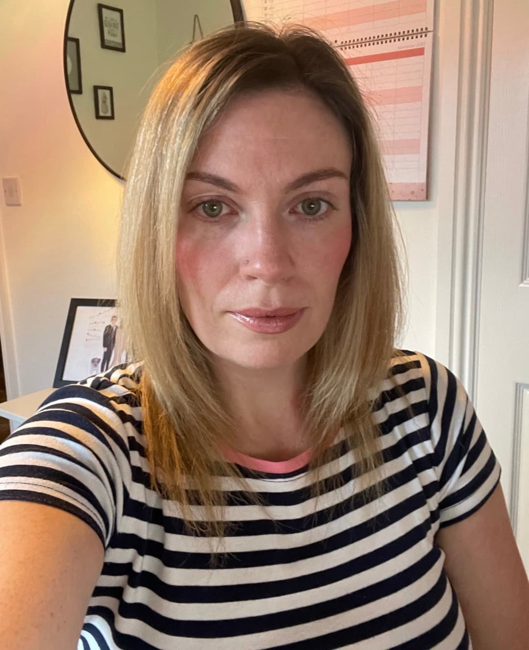 Fiona Thomas East Kilbride Glasgow Lanarkshire Glasgow freckles prove