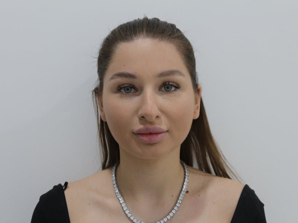 Big fake tits big fake lips beautiful silicone bimbo #14