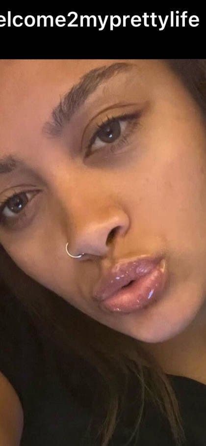 Duck lips pouting teens dsl