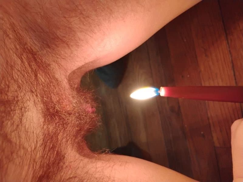 Ugly ftm pig runs salt and vinegar in ruined cunt and drips wax on cunt Kik bullmaster999 to be next