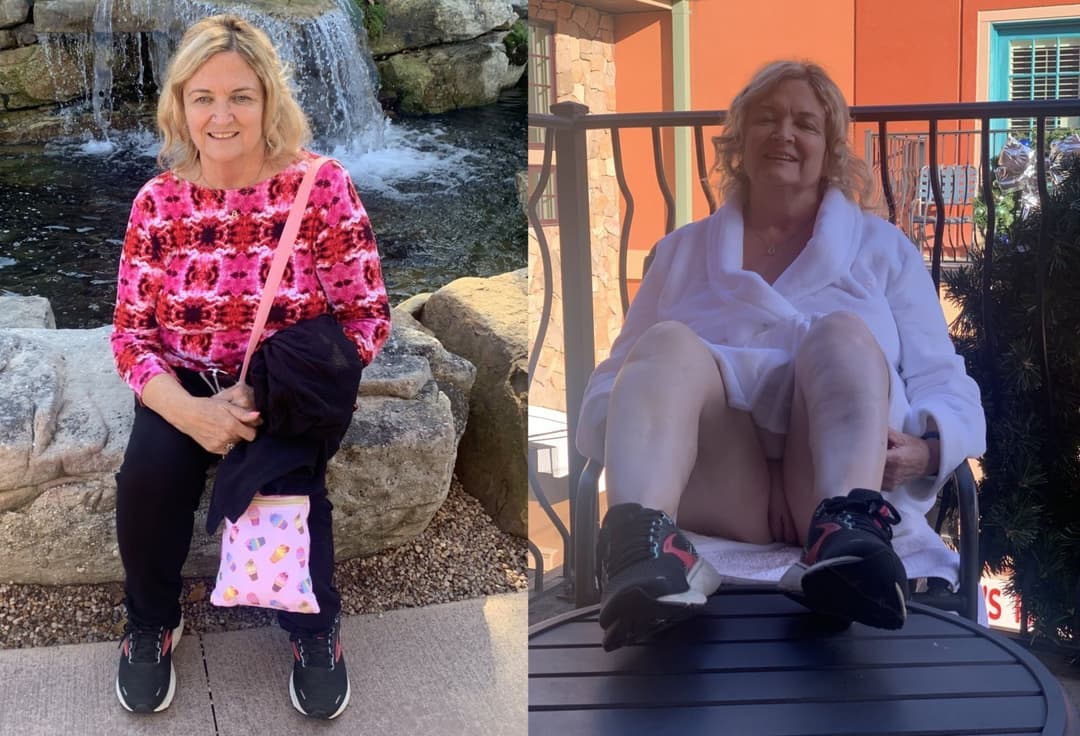 Melissa in her prime - then & now