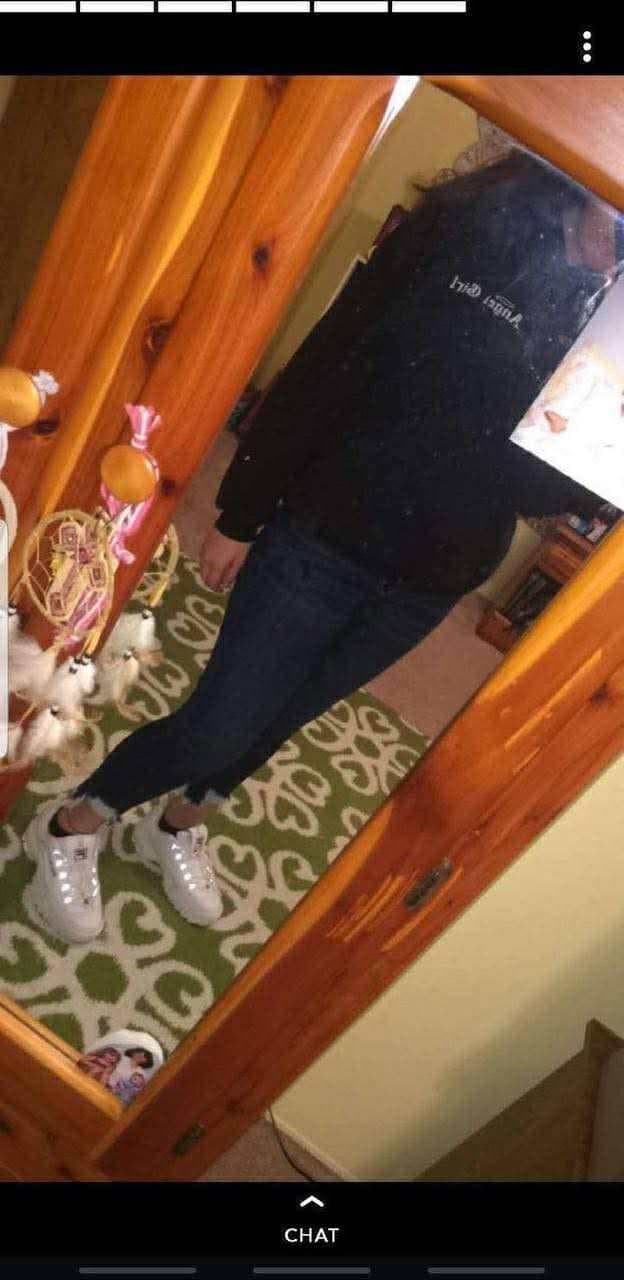 Brace face and her fart dispenser she loves to fart out of