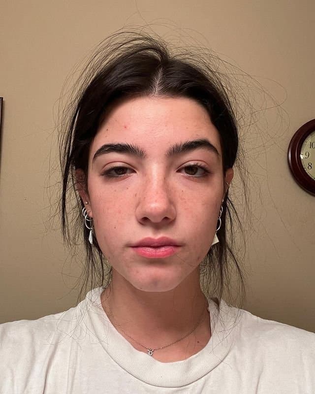 Charlie hotd‘amelio ??