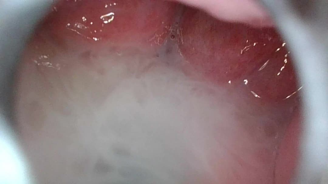 With the endoscope in her vagina, fingered her, licked her, and then insert my penis and cum inside.