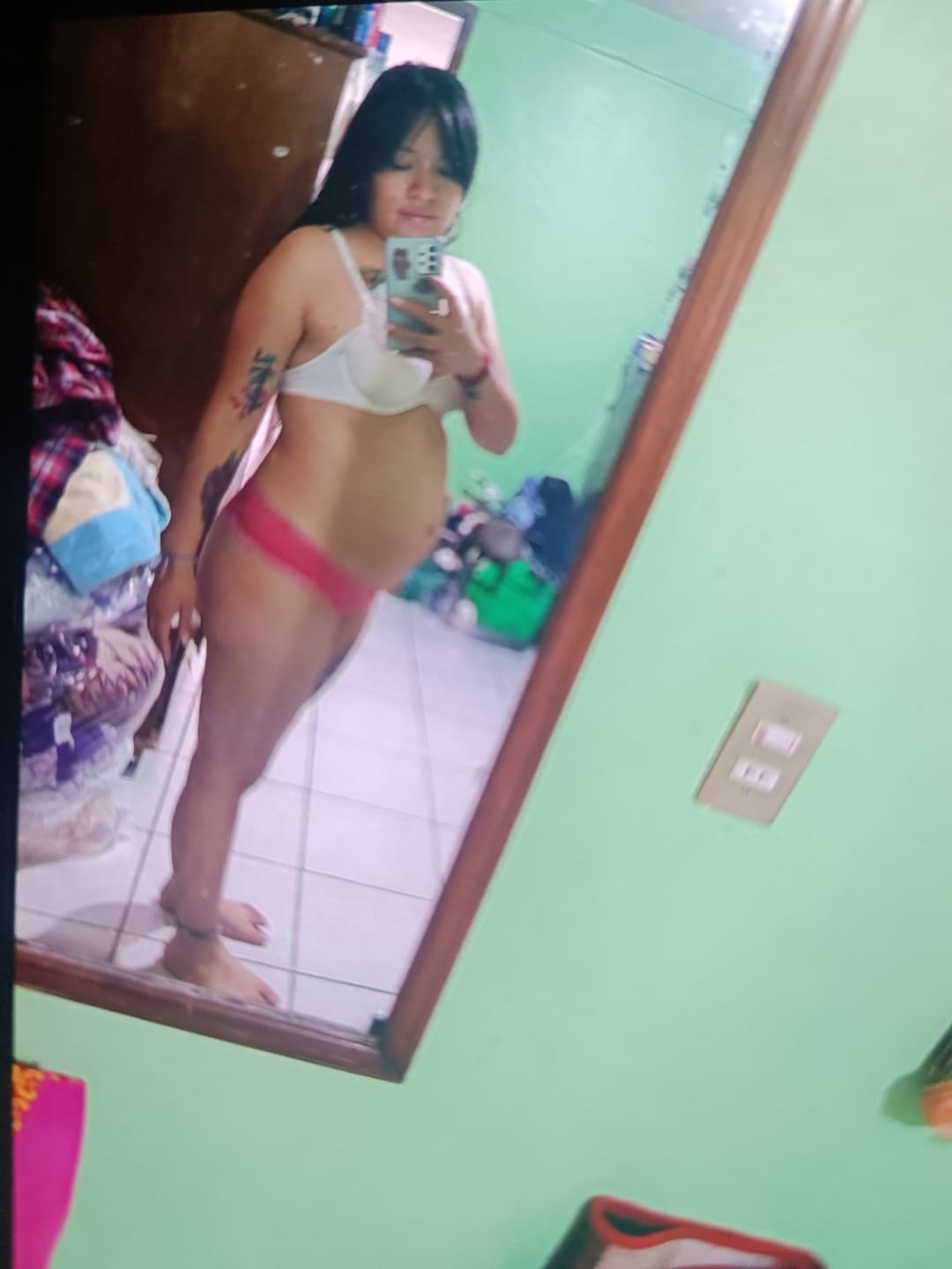 Ana ex alumna de la Unitec Campus Sur quemada por su esposo