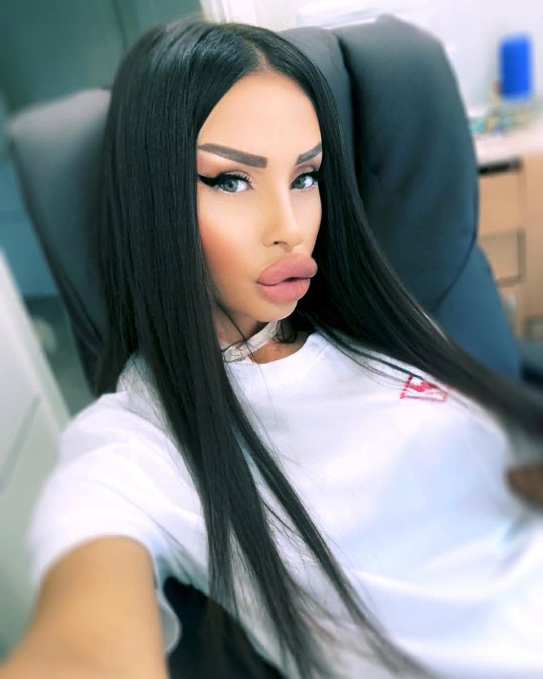 Huge Bimbo Duck Lips