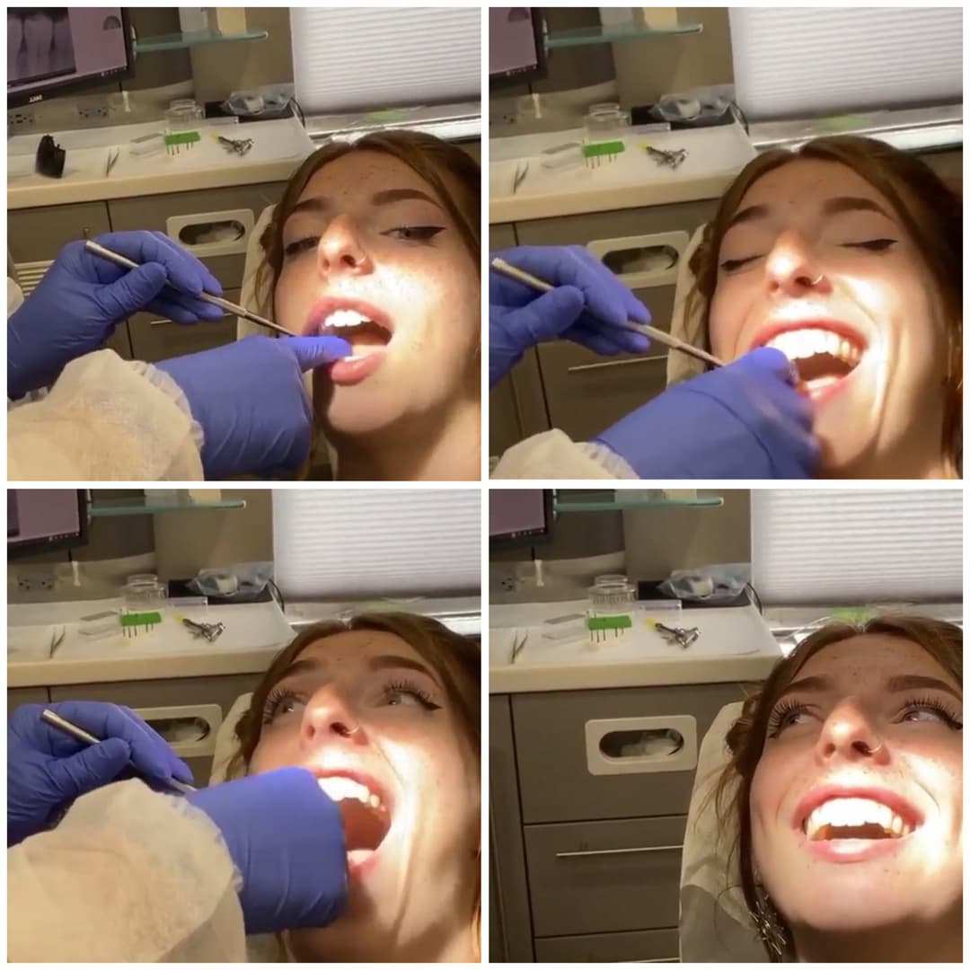 Slut Was Being Too Freaky At Her Dentist Appointment