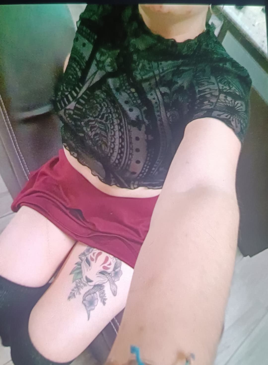 Ana ex alumna de la Unitec Campus Sur quemada por su esposo