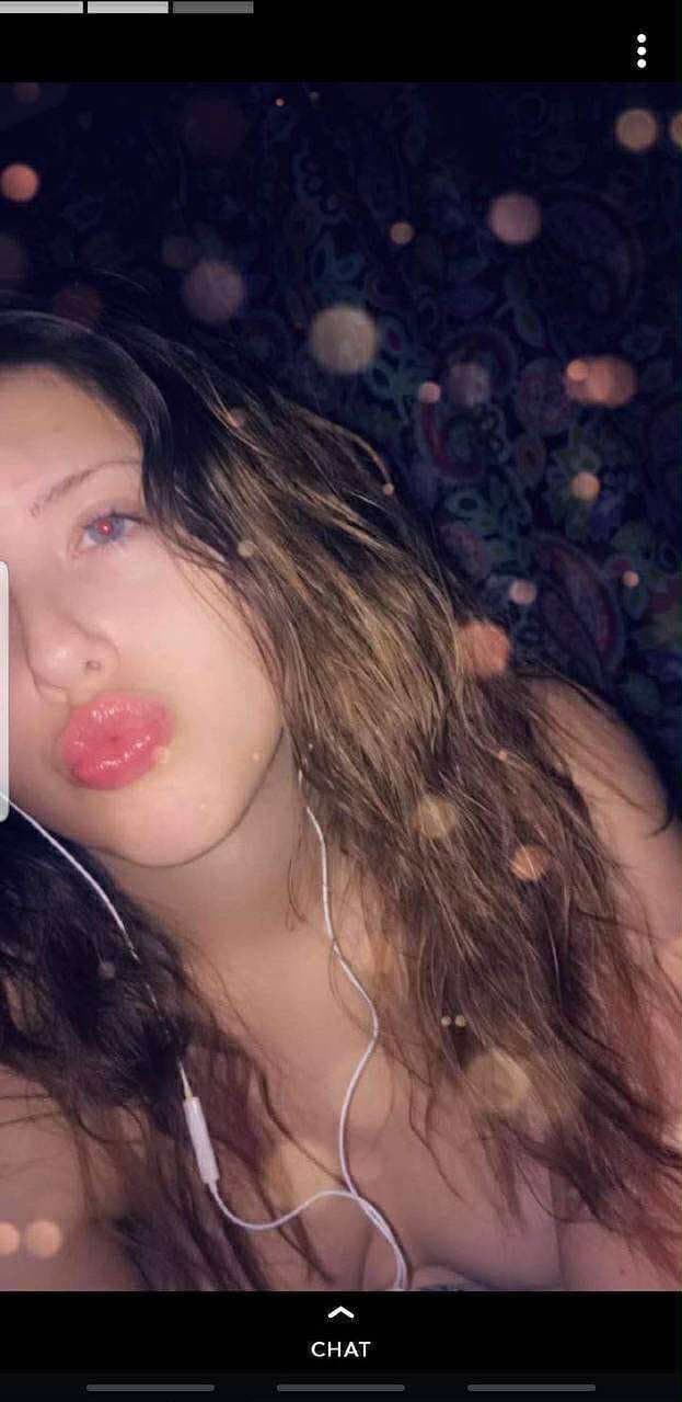 Brace face and her fart dispenser she loves to fart out of