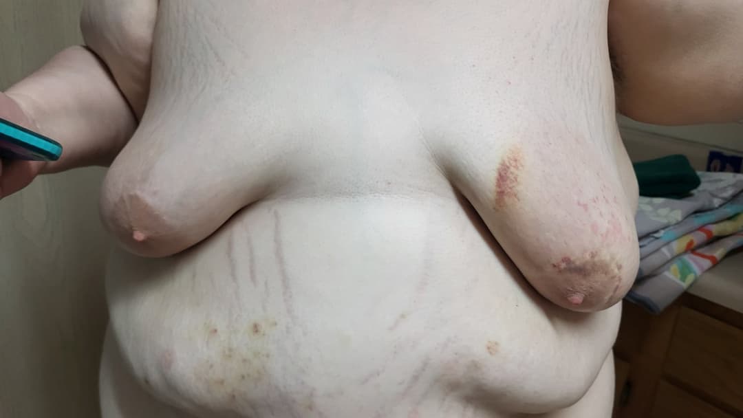 Heavy BDSM Brusing Over A Week