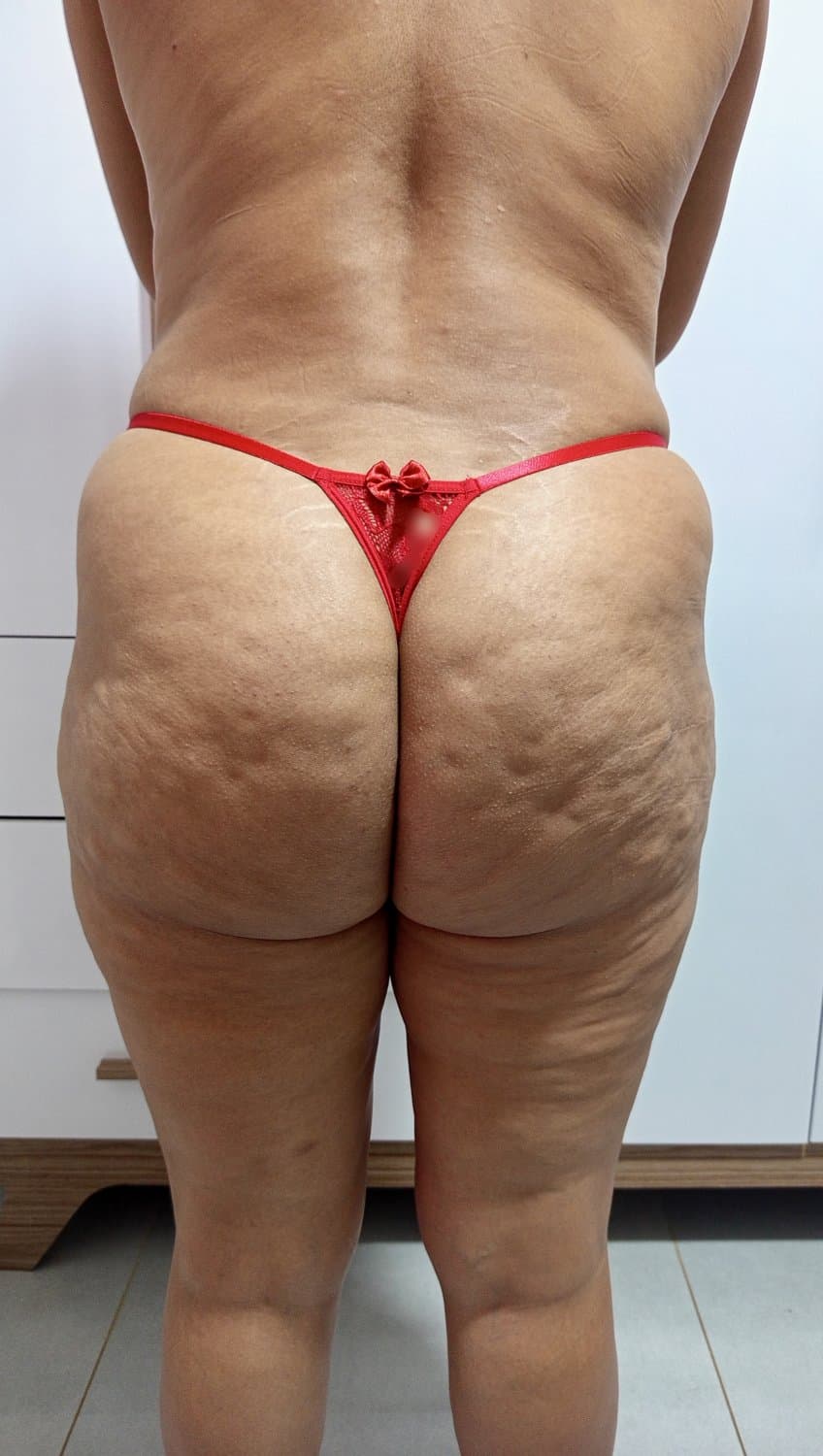 Bundona da esposa com celulite