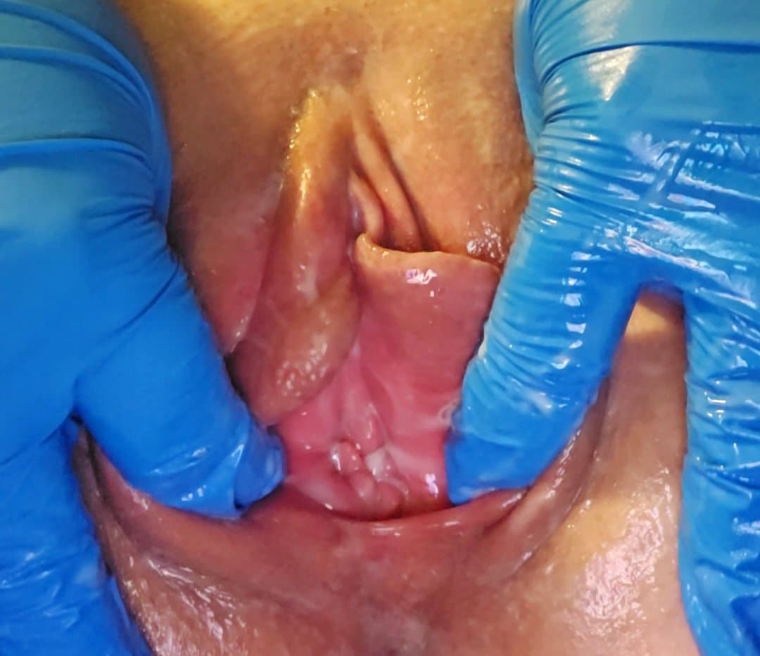 Click to view full size Charlotte spreading her meaty swollen pussy. Her KIK: LickMySwollenPus